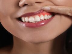 ¿Por qué sangran las encías? Primeros síntomas de alerta que no debes ignorar