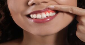 ¿Por qué sangran las encías? Primeros síntomas de alerta que no debes ignorar